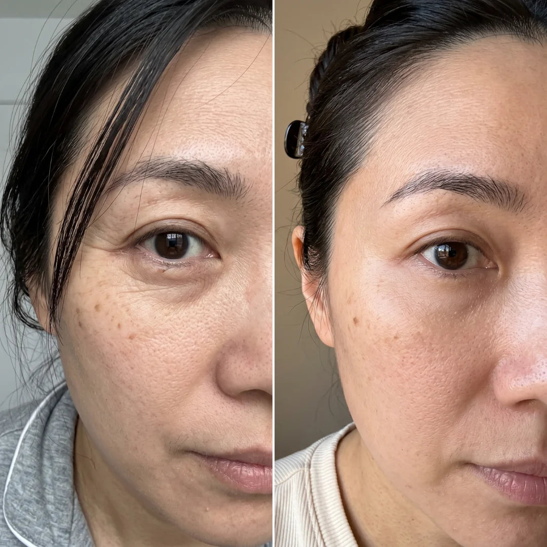 ✨ VIRAL FAVORITE: Clinclii P7 Eye Cream at 50% Off — While Stock Lasts 🔥